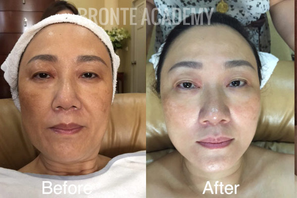 before_after2.jpg