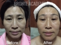 before_after1.jpg